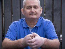 معجزة علمية.. أول رجل في العالم بيدين مزروعتين (صورة)